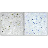 NRIP2 Antibody