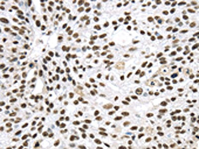 DDX39B Antibody