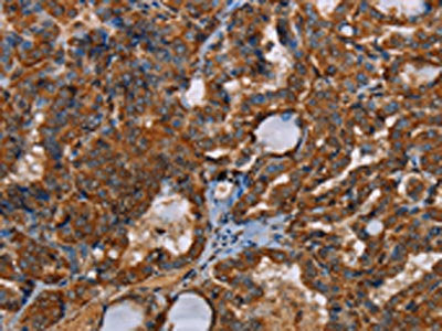 POU6F2 Antibody