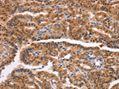 NCAPG2 Antibody