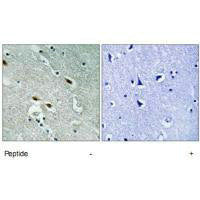 TP53BP1 Antibody