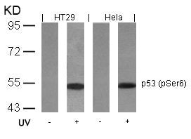 Phospho-TP53 (Ser6) Antibody