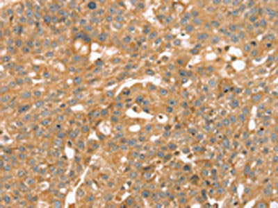TRIM45 Antibody