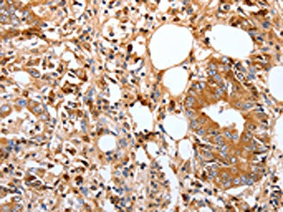 FOXO3 Antibody