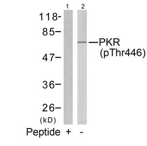 Phospho-EIF2AK2 (Thr446) Antibody