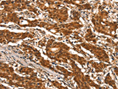 DDX4 Antibody