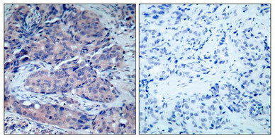 MAP2K4 (Ab-261) Antibody