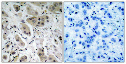 Phospho-AKT1 (Ser473) Antibody