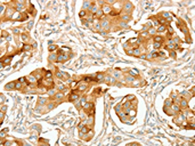 ACE Antibody