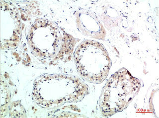 HSPA8 Antibody