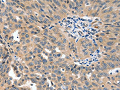 P2RY6 Antibody