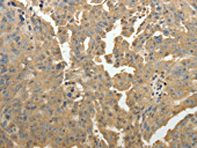 PSMD9 Antibody