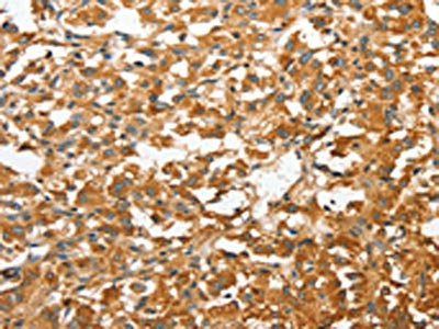 ANXA9 Antibody