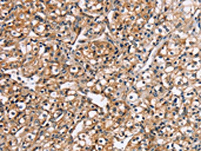 RGS1 Antibody