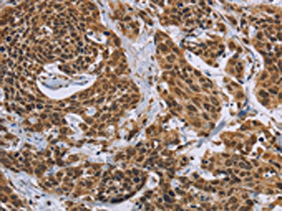 CCL21 Antibody