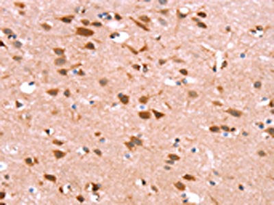 GH1 Antibody