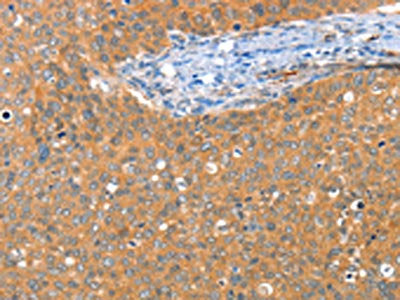 ACY3 Antibody