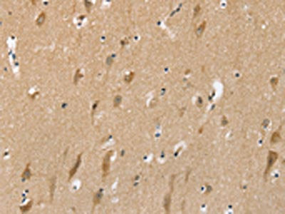 SLC6A7 Antibody
