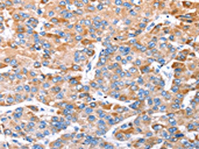 TRIM14 Antibody