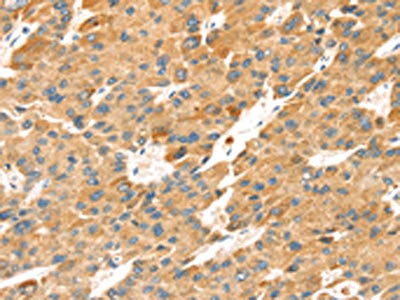 TNFSF15 Antibody