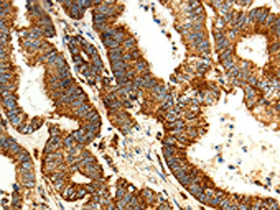 MAP1LC3A Antibody