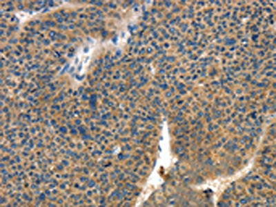 COL4A2 Antibody