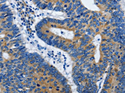 BPIFB3 Antibody