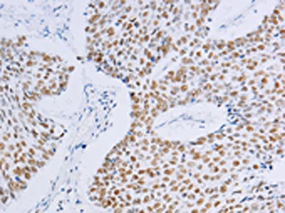 MCM2 Antibody