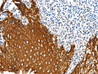 ANXA9 Antibody