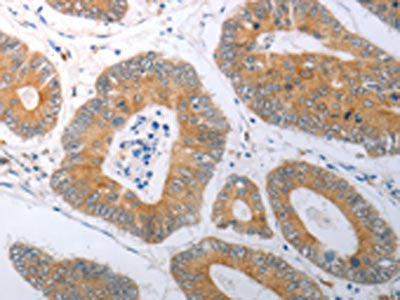 RBMS3 Antibody