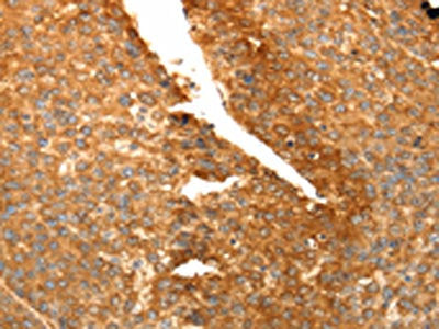 SPATA2L Antibody
