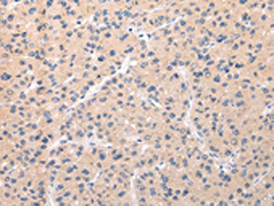 ABCC1 Antibody