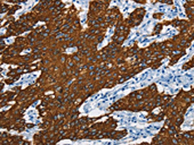 KRT8 Antibody