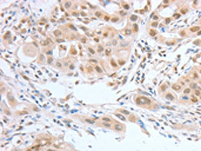ATF2 Antibody