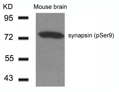Phospho-SYN1 (Ser9) Antibody