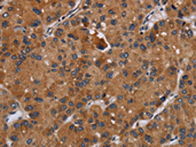 DISC1 Antibody