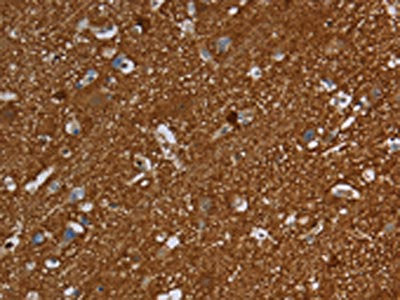 SNCG Antibody