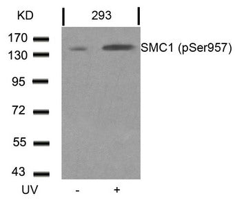 Phospho-SMC1A (Ser957) Antibody