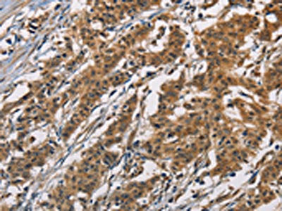 ATP2C1 Antibody