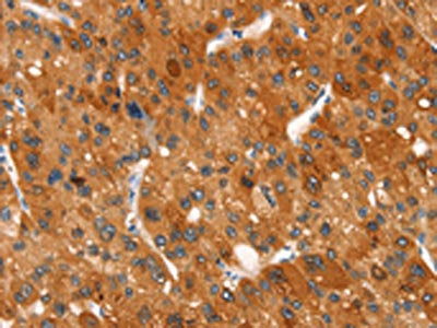 CLEC6A Antibody