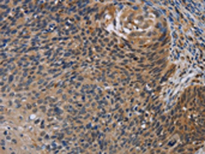 STAT1 Antibody