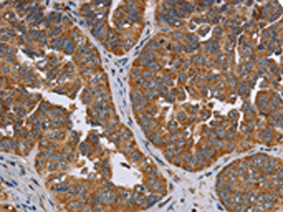 ADAMTS15 Antibody