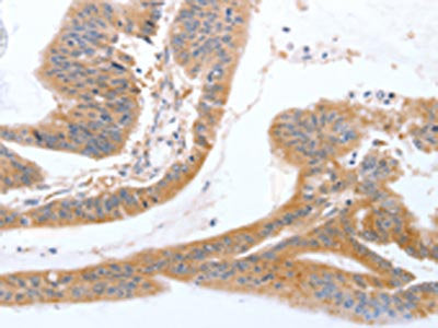 TGFA Antibody