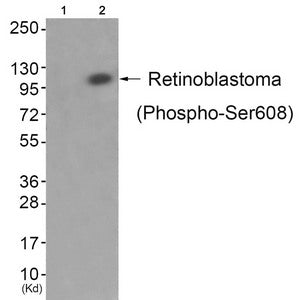 Phospho-RB1 (Ser608) Antibody
