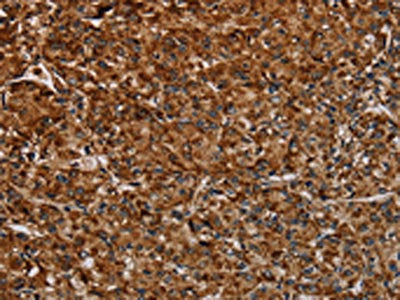 NDUFAB1 Antibody