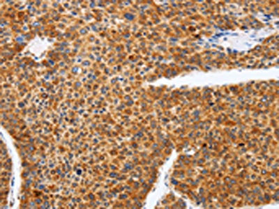 SPATA13 Antibody