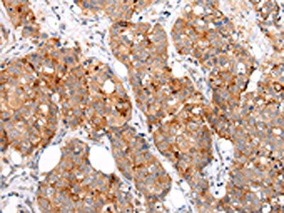 MUC1 Antibody