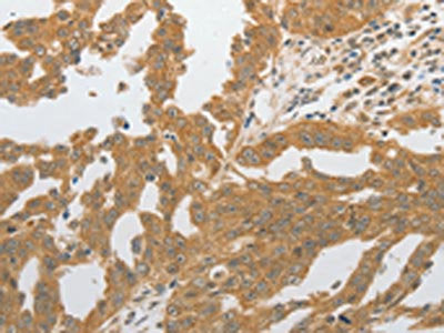 GRIN2C Antibody