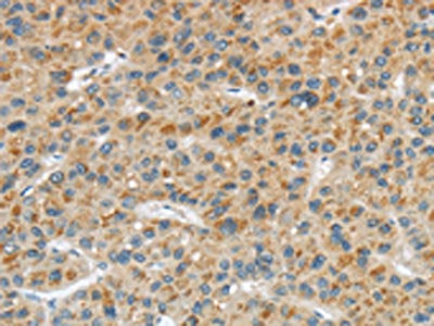 LPAR1 Antibody