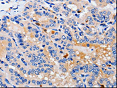 CDK10 Antibody